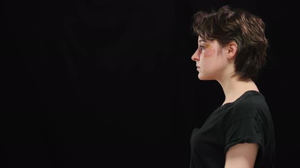 Side View of Young Woman with Beaten Face in Bruises on the Right at Black Background alt