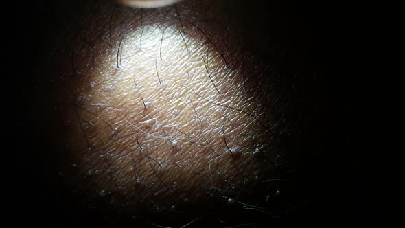 Human Skin Analysis alt