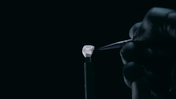 Grinding of Veneer Close Up alt