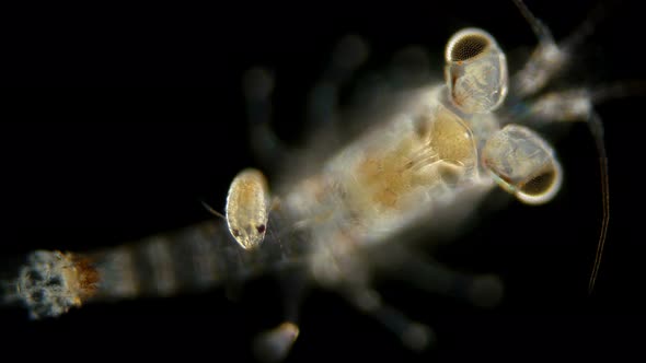 Mizida Shrimp and the Parasitic Isopoda Larva Under a Microscope, at the Stage of Kryptonium alt