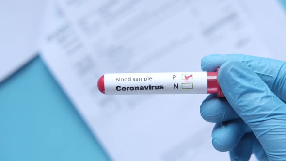 Hand in Blue Medical Gloves Holding Blood Test Tube and Medical Report on Table alt
