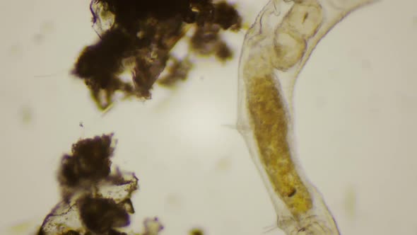 Nematode Under The Microscope alt