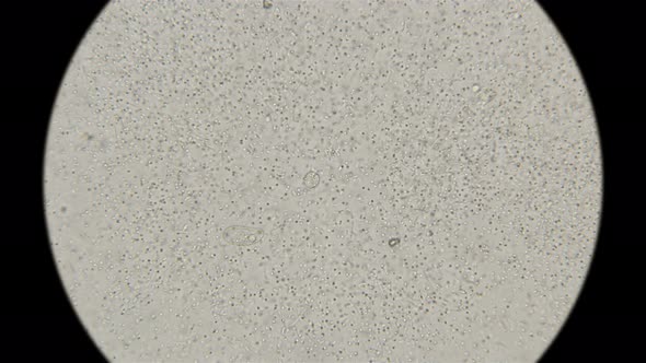 Drop of Water  From a Water Purification Filter, Colony of Bacteria alt