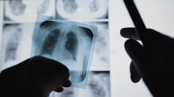 Silhouette of doctor examining lungs x-ray. Medical concept 4K