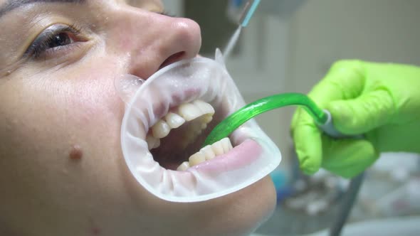 Young Woman with an Expander in Mouth at the Dental Clinic alt