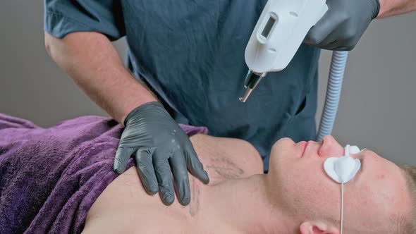 Laser Tattoo Removal in the Clinic of Aesthetic Medicine