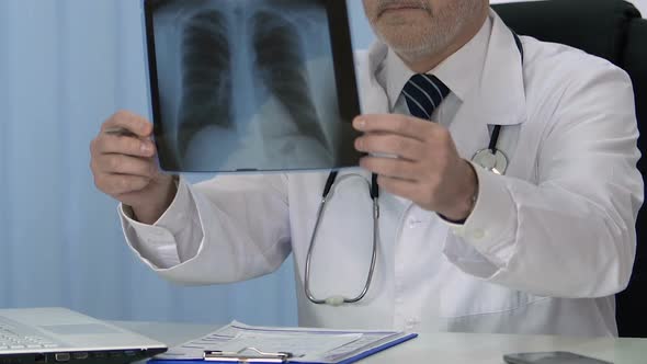 Pulmonologist Checking Patient Lung Scan, Writing Diagnosis in Medical Record alt
