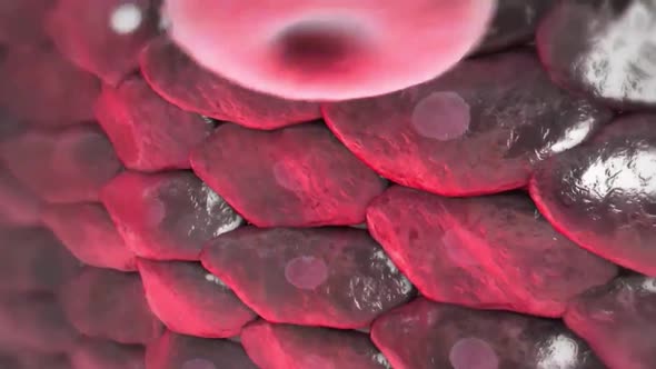 SCAD; is an emergency that occurs when a tear occurs in a blood vessel in the heart. alt