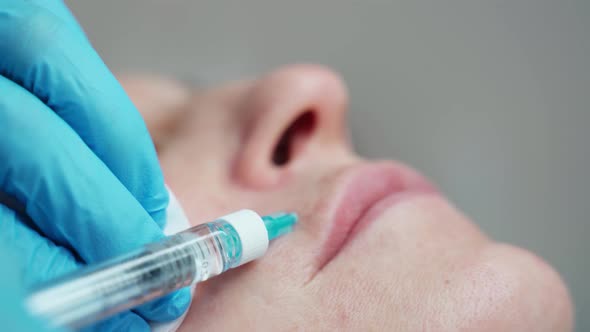 A Cosmetologist at a Beauty Salon Makes an Injection of Hyaluronic Acid Into the Skin of an Adult alt