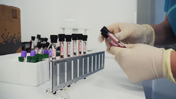 Laboratory Assistant Prepares Blood Tubes For Analysis