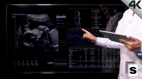 Ultrasound Prenatal Control