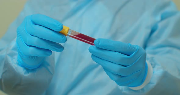 Coronavirus COVID-19 Infected Blood Sample in Doctor Scientist Hands. Epidemic and Virus Outbreak. alt