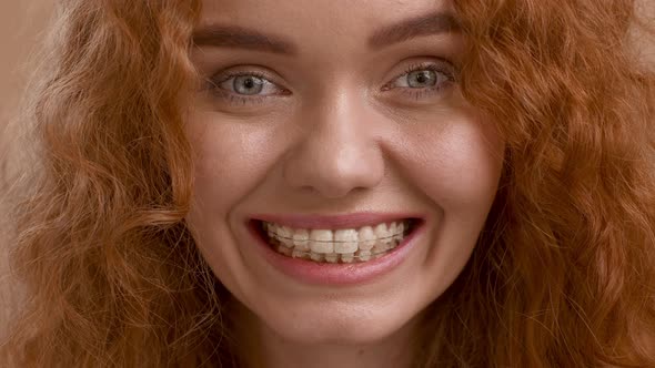 Lady With Braces Smiling Snapping Teeth Posing Over Beige Background alt
