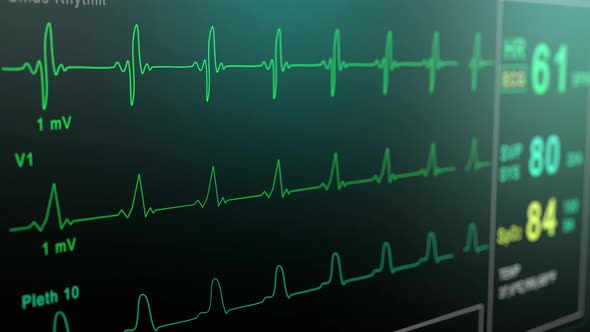Heart Rate Monitor in Hospital Theater. Medical Vital Signs Monitor Instrument in a Hospital on alt
