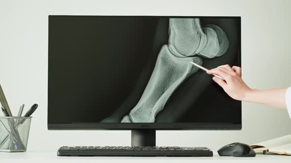 Doctor Veterinarian Examining Horse Leg Skeleton Roentgen on Computer Monitor alt