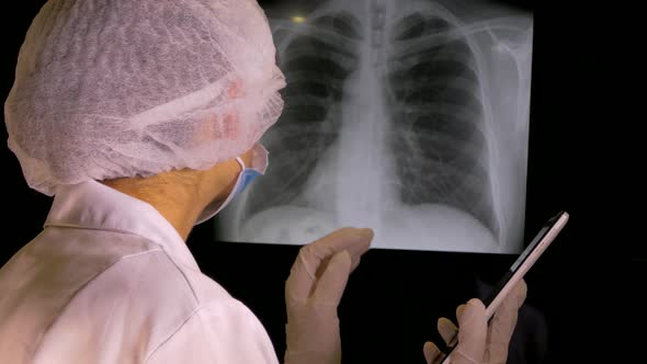 The doctor looks at the x-ray of the lungs. Pneumonia diagnosis