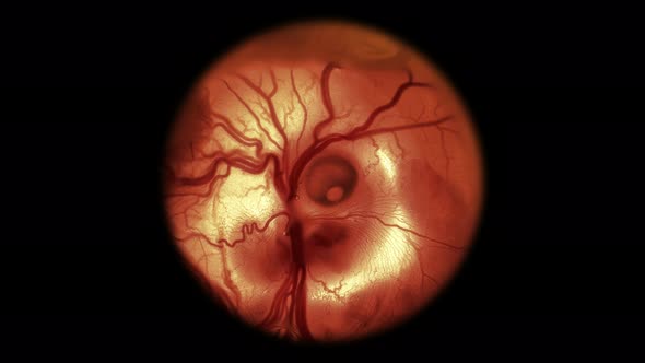 Heartbeat and Movement of Blood Through the Vessels of a Chicken or Quail Embryo in an Egg alt