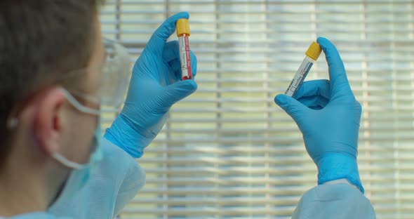 Coronavirus Test in Laboratory. Covid 19. Arm in Plastic Gloves Holding Test Tubes with Test Sample alt