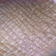 Human Skin Analysis - VideoHive Item for Sale
