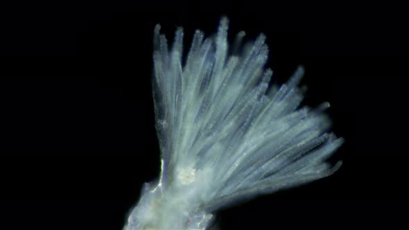 Polychaeta worm, order Sabellida under a microscope. Possibly family Fabriciidae alt