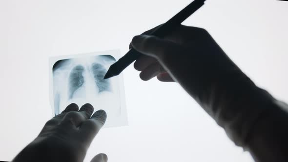 Top view of doctors hands examining lungs x-ray on white background. Medicine Concept