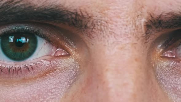 Real Black Eye on the Young Male Face Bruise on a Man Eyelid alt