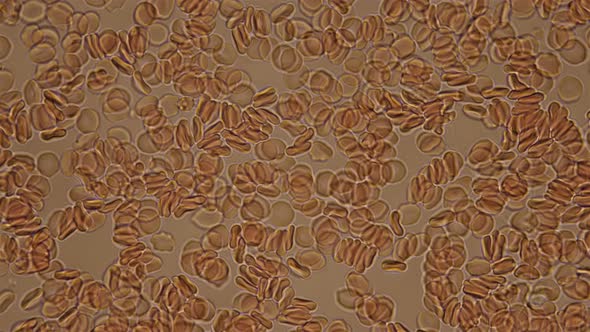Blood Under a Microscope, the Movement of Red Blood Cells, Cells That Carry Oxygen Throughout the alt