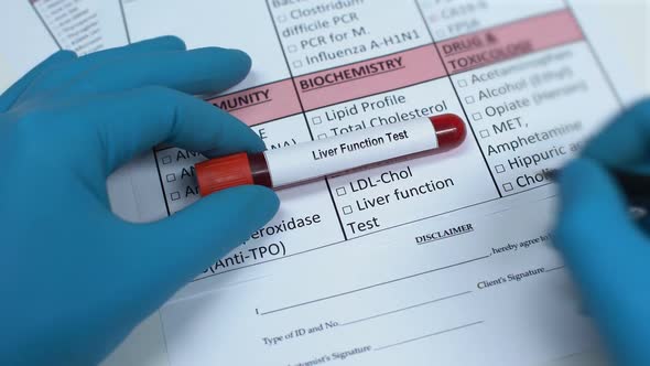 Liver Function, Doctor Checking Name in Lab Blank, Showing Blood Sample in Tube alt