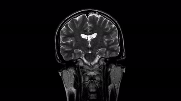 Brain MRI, Head Scans and Tumor Detection. Diagnostic Medical Tool alt