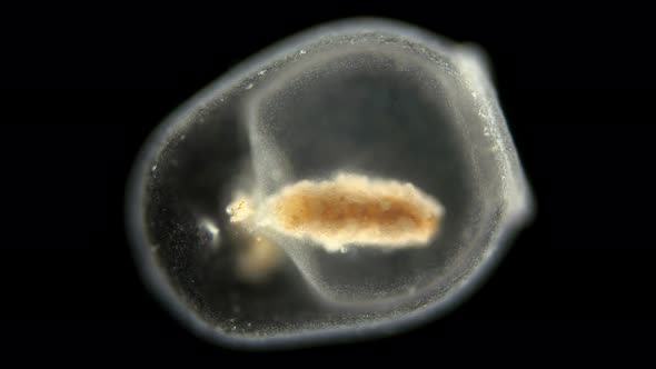 Swimming Bells - Nectocalyces or Nectophore Under a Microscope, Part of the Siphonophora Colony alt