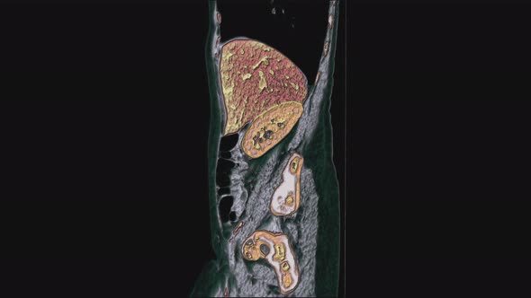 Bulk Multicolored MRI of the Female Pelvic Organs, Abdominal Cavity, Gastrointestinal Tract and alt