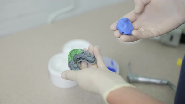 Dental Productivity Models Printed on Professional 3D Printing Machine Inside Stomatology Clinic