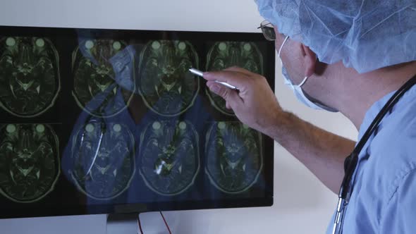 Doctor Examining An MRI Scan Of The Brain On Monitor 07