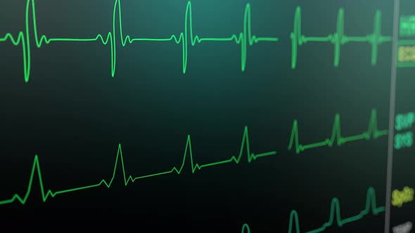 Heart Rate Monitor in Hospital Theater. Medical Vital Signs Monitor Instrument in a Hospital on alt