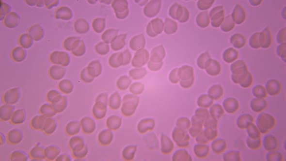 Microscopy: Human Blood. Blood Clots Under Microscope 05