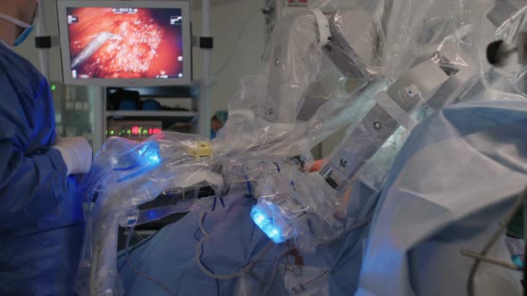 Minimally Invasive Robotic Surgery using advanced technology in a hospital alt