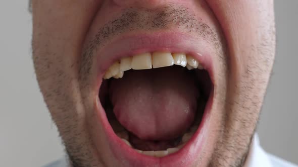 Sick Man Opening His Mouth alt