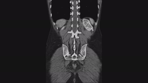 Voluminous MRI of the Female Pelvic Organs, Abdominal Cavity, Gastrointestinal Tract and Bladder alt