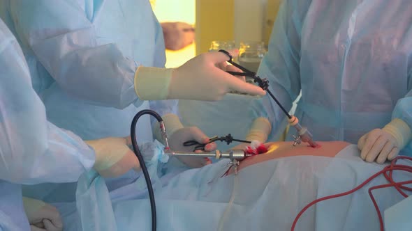 Surgical Operation. The Doctor is Doing Surgery on a man. Surgery Clinic alt