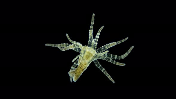 Adult Larva of Sea Anemone Actiniaria Under Microscope Class Anthozoa Phylum Cnidaria alt