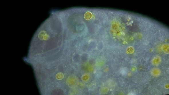 Stentor Ciliophora Infusoria under microscope, family Stentoridae, class Ciliata alt