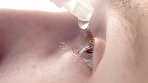 Closeup Young Man Drops Eye Drops Install Lenses Moisturizing Using Medical Eyes Drops Suffering alt