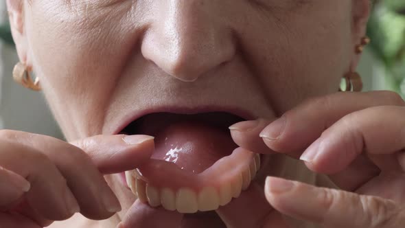 Woman with false teeth, close up. Dental concept. Mouth of female pulls upper jaw out alt
