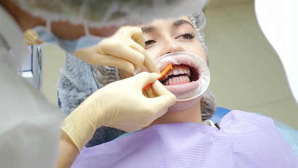Professional Dental Hygiene Procedure in Dentistry alt