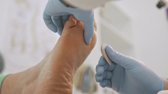 The Doctor Carefully Examines the Foot of a Patient with Flat Feet