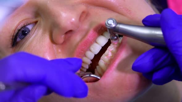 Dentist Examines a Female Patient's Teeth with a Mirror and Special Dental Tools alt