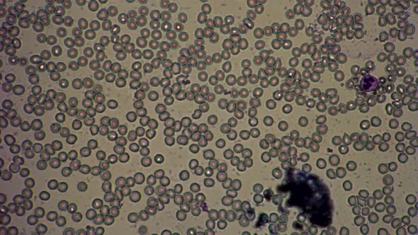Smear of Human Blood Red Red Blood Cells in a Microscope, Stock Footage