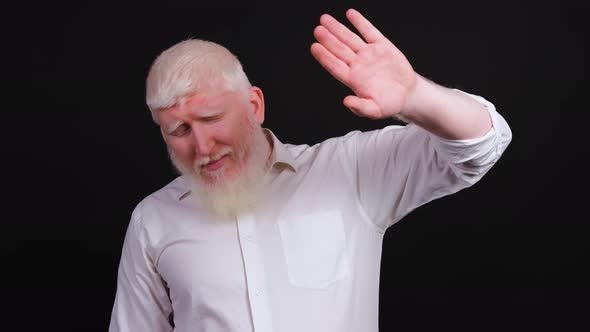 Man with Albinism Raises His Hand to Protect His Eyes From Bright Light and Puts on His Sunglasses alt