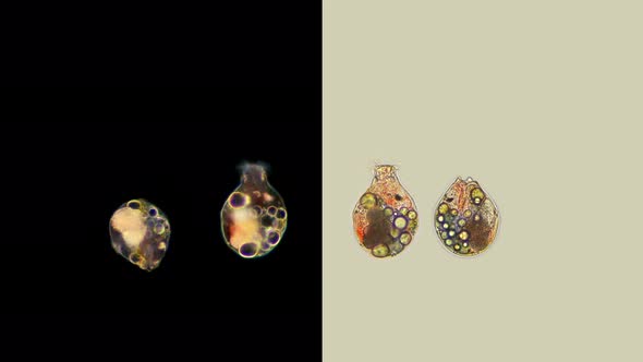 Rotifera Gastropus Sp. Under the Microscope, the Family Gastropodidae alt