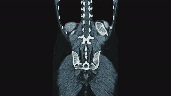 Voluminous Color MRI of the Female Pelvic Organs, Abdominal Cavity, Gastrointestinal Tract and alt